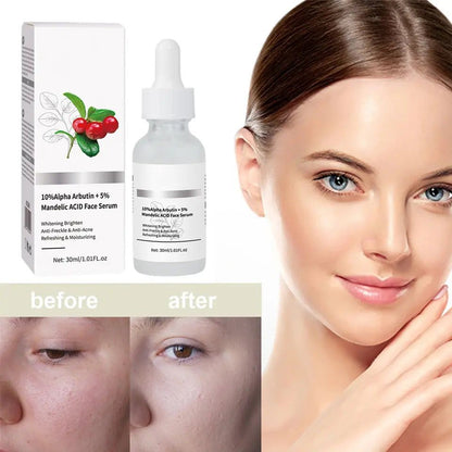 Aichun Beauty 10%Alpha Arbutin + 5% Mandelic Acid Face Serum 30ml