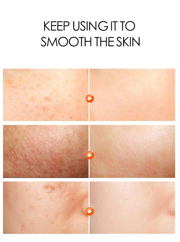 Dr.Rashel Reduce Pigmentation Moisturizing Skin White Day Cream Vitamin E Cream 50G