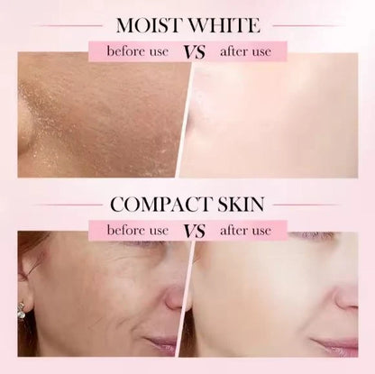 Sadoer Hyaluronic Acid Nicotinamide 4 In 1 Whitening Nourishing Firming Anti Wrinkle Skin Vitamin C, E Face Cream